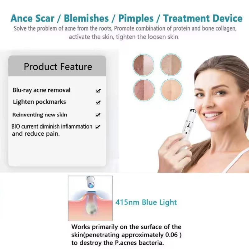 Magic Blue Light™ — Pluma de tratamiento luz led azul